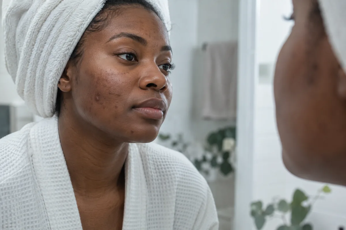 Close portrait showing natural skin texture and a few facial blemishes